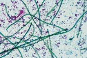 Cyanobacteria, Mixed Slide