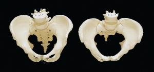 3B Scientific® Pelvic Skeleton Models