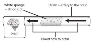 Science Take-Out® Testing A Clot Buster