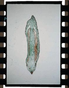 <i>Mnium</i>, Sporophyte Slide