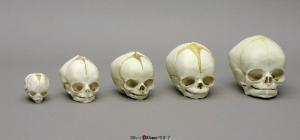 Human Fetal Skulls, Set of 5