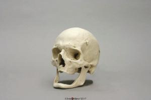 Elderly Human Male European Skull