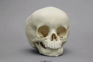 Human Child Skull 15-month-old