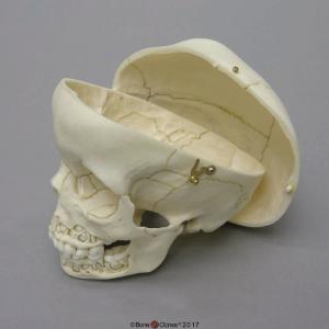 Human Child Skull 5-year-old, Mixed Dentition Exposed and Calvarium Cut