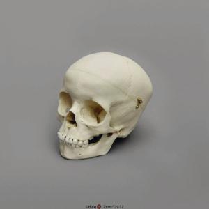 Human Child Skull 5-year-old, Calvarium Cut