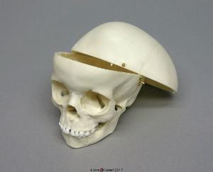 Human Child Skull 5-year-old, Calvarium Cut