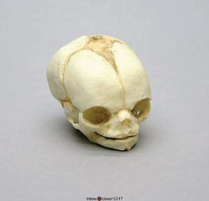 Human Fetal Skull 21 1/2 Weeks