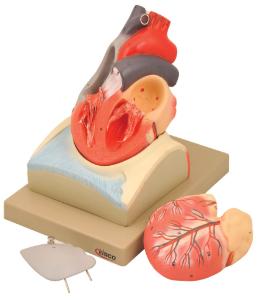 Eisco® Heart On Diaphragm
