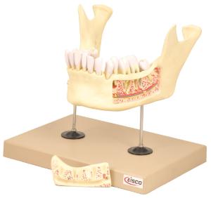 Eisco® 21 Part Dental Disease