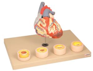 Eisco® Heart Condition