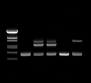Kit detecting COVID-19 using RT-PCR