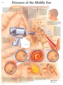 3B Scientific® Ear Disease Chart