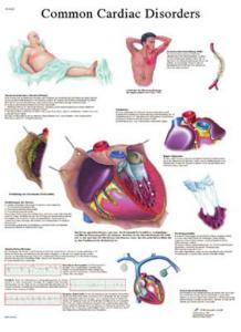 3B Scientific® Heart Disease Chart