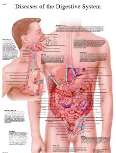 3B Scientific® Digestive Disease Chart