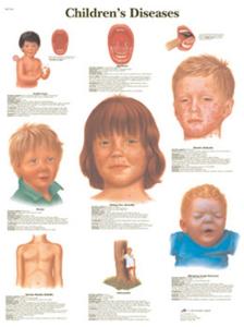 3B Scientific® Child Diseases Chart