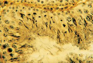 Testis, Spermatogenesis, Mammal Slide