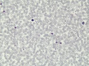 <i>Plasmodium cynomolgi </i>Slide