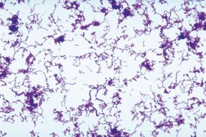 Ward's® Live <i>Streptococcus pyogenes</i> Culture - PATHOGEN
