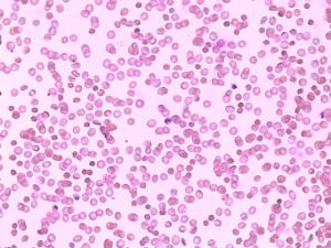 Smear Plasmodium falciparum Slide