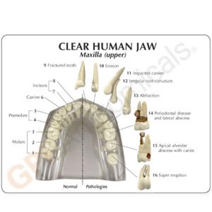GPI Anatomicals® Clear Human Jaw with Teeth Model