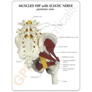 GPI Anatomicals® Muscled Hip with Sciatic Nerve