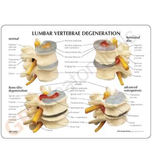 GPI Anatomicals® 4-Stage Vertebrae