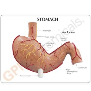 GPI Anatomicals® Stomach Cancer Model