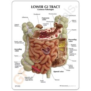 GPI Anatomicals® Gi Tact