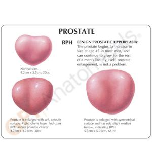 GPI Anatomicals® Male Pelvis with 3D Prostate Frame Model