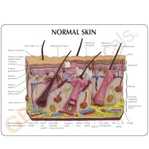 GPI Anatomicals® Skin Normal/Acne Model