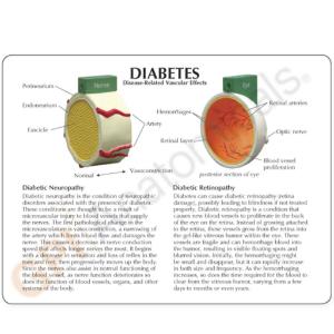GPI Anatomicals® 4-Piece Diabetes Model