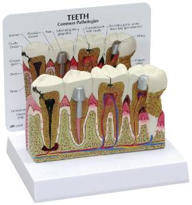 GPI Anatomicals® Basic Teeth Model
