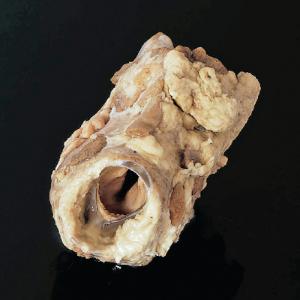 Preserved Mammalian Larynx, Sheep or Pig