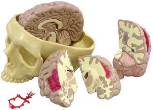 GPI Anatomicals® Brain in Skull Pathologies Model