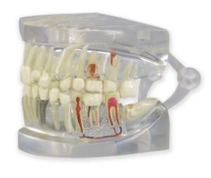 GPI Anatomicals® Clear Human Jaw with Teeth Model