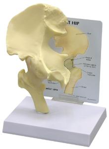 GPI Anatomicals® Basic Hip