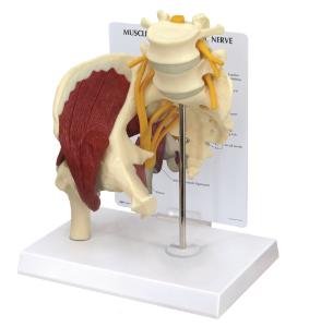 GPI Anatomicals® Muscled Hip with Sciatic Nerve Model