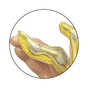 GPI Anatomicals® Rhumatoid Arthritis Hand