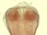 Tapeworm, Comparative Scolices Slide