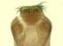 Tapeworm, Comparative Scolices Slide