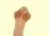 Tapeworm, Comparative Scolices Slide