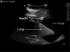 Chest tube/ultrasound guided thoracentesis model
