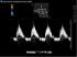 Peripheral doppler µltrasound training model