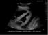 Transthoracic echocardiography and pericardiocentesis µltrasound training model