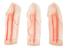 True anatomy series sclerotherapy vascular leg model