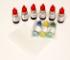 Simulated Blood Typing "Whodunit" Kit