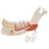 3B Scientific® Advanced Half Lower Jaw With 8 Diseased Teeth