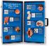 Consequences Of High Blood Pressure Display