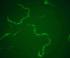 Expression of <i>C. elegans</i> Kit