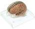 Somso® Brain Model with Dura